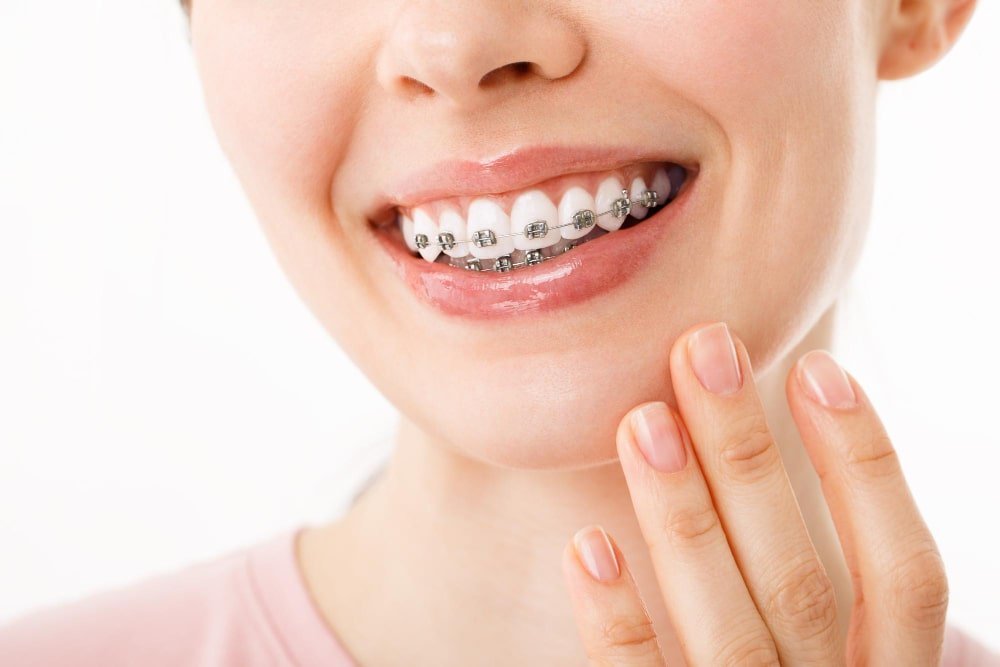 Root Canal