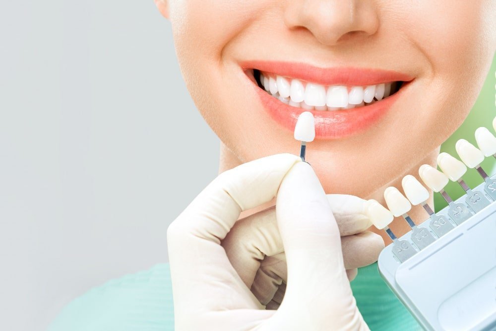 Root Canal